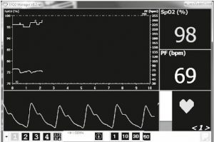 Biểu đồ nồng độ oxy trong máu ( biểu đồ SPO2 )