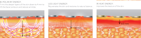 Máy nâng cơ trẻ hóa da mặt Silk’n FaceTite Z -3 nguồn năng lượng